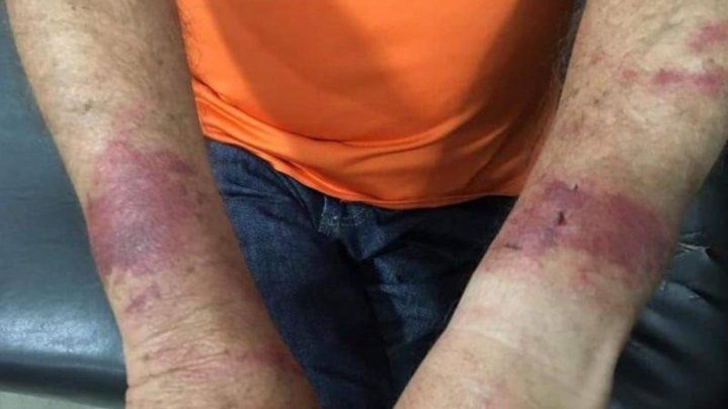 Idoso é amarrado, espancado e tem aposentadoria de R$ 700 levada por bandidos em Colíder
