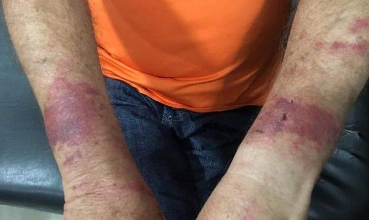 Idoso é amarrado, espancado e tem aposentadoria de R$ 700 levada por bandidos em Colíder