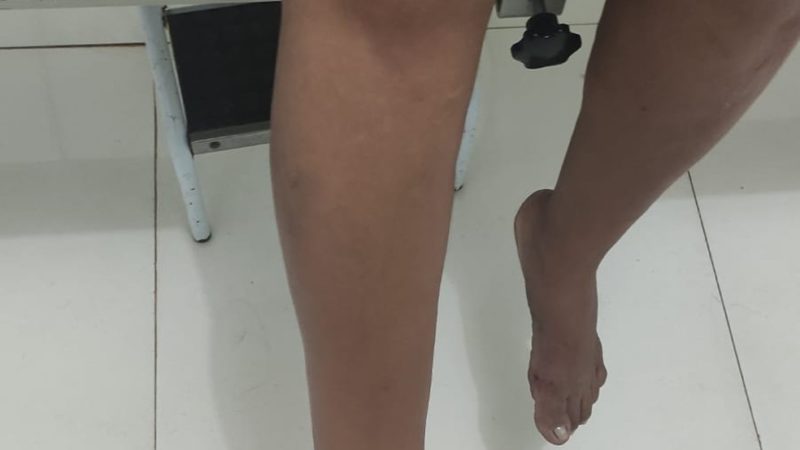 Mulher fica ferida após pular do 1º andar para fugir de agressões do marido