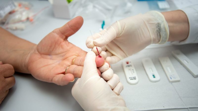 Número de pacientes com HIV/Aids tem aumento de 84% em Sorriso